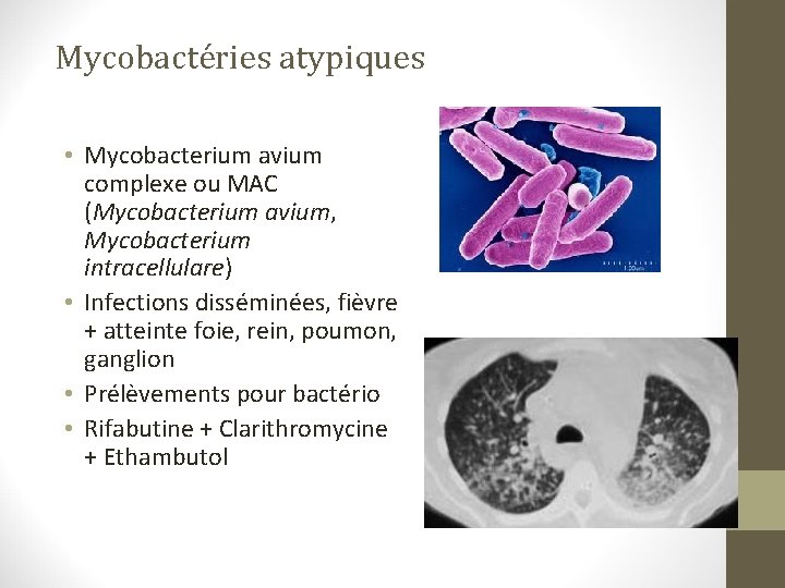 Mycobactéries atypiques • Mycobacterium avium complexe ou MAC (Mycobacterium avium, Mycobacterium intracellulare) • Infections Mycobactéries atypiques • Mycobacterium avium complexe ou MAC (Mycobacterium avium, Mycobacterium intracellulare) • Infections