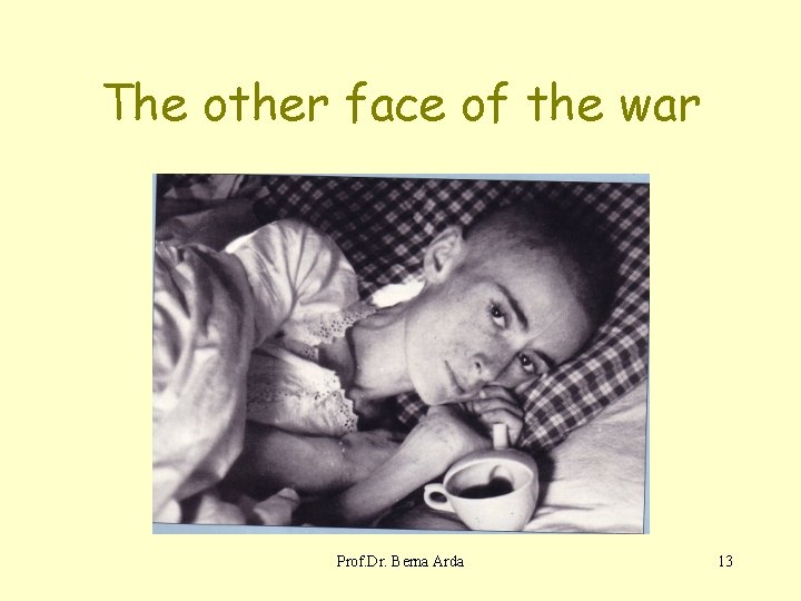 The other face of the war Prof. Dr. Berna Arda 13 