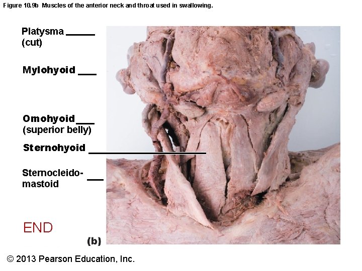 Figure 10. 9 b Muscles of the anterior neck and throat used in swallowing.
