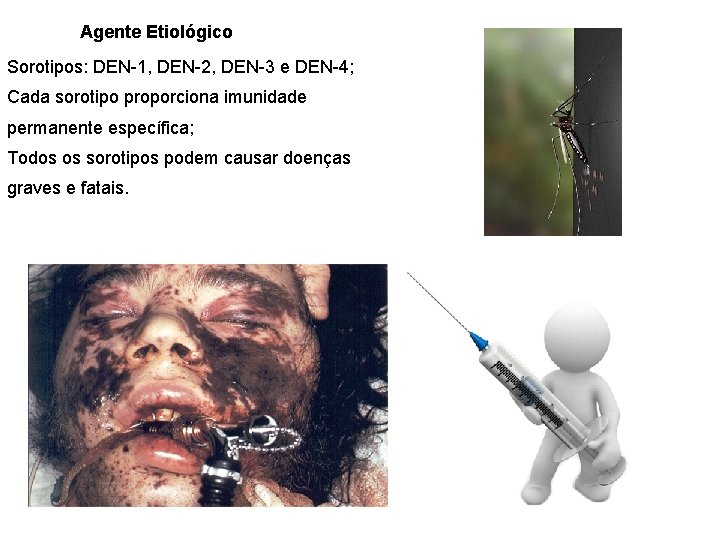 Agente Etiológico Sorotipos: DEN-1, DEN-2, DEN-3 e DEN-4; Cada sorotipo proporciona imunidade permanente específica;