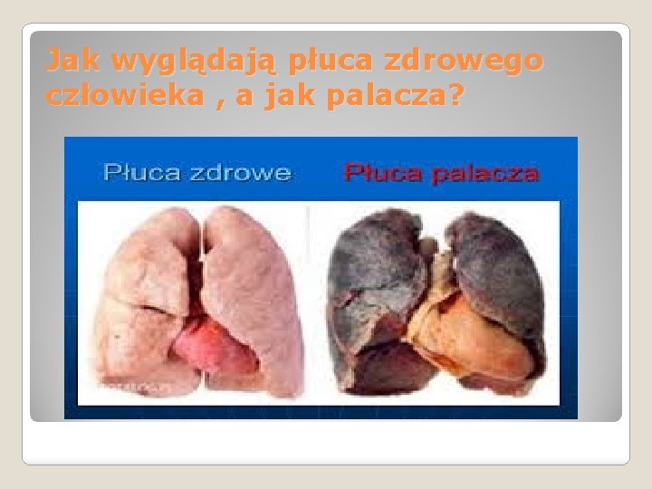 Jak wyglądają płuca zdrowego człowieka , a jak palacza? 