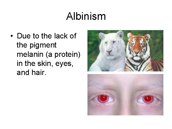 Albinism • Due to the lack of the pigment melanin (a protein) in the