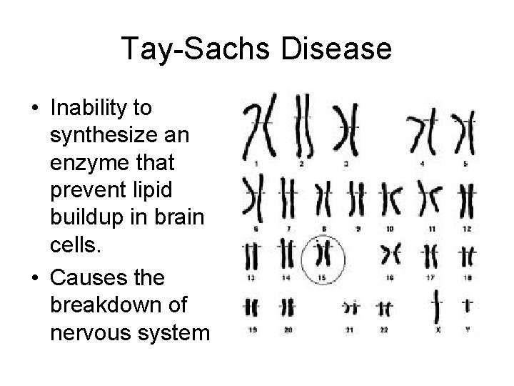 Tay-Sachs Disease • Inability to synthesize an enzyme that prevent lipid buildup in brain