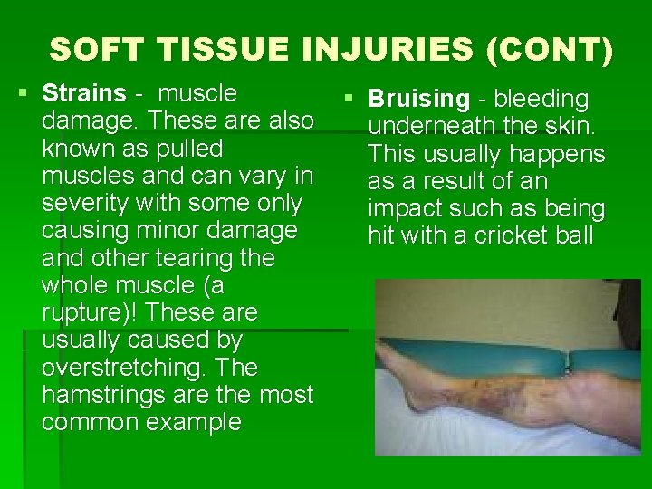 SOFT TISSUE INJURIES (CONT) § Strains - muscle damage. These are also known as SOFT TISSUE INJURIES (CONT) § Strains - muscle damage. These are also known as