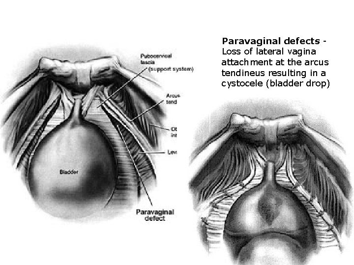 Pelvic Floor And Functional Anatomy Assoc Prof Gazi