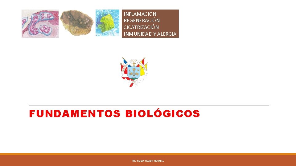 INFLAMACIÓN REGENERACIÓN CICATRIZACIÓN INMUNIDAD Y ALERGIA FUNDAMENTOS BIOLÓGICOS DR. HUGO TEJADA PRADELL 
