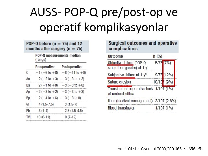 AUSS- POP-Q pre/post-op ve operatif komplikasyonlar Am J Obstet Gynecol 2009; 200: 656. e