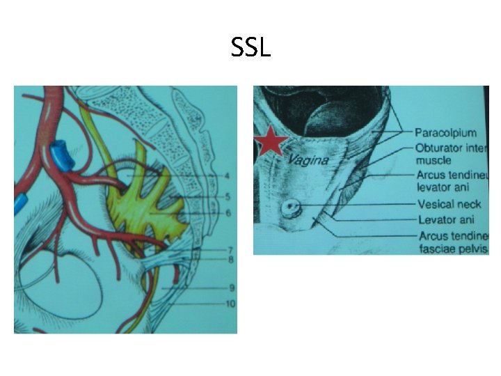 SSL 