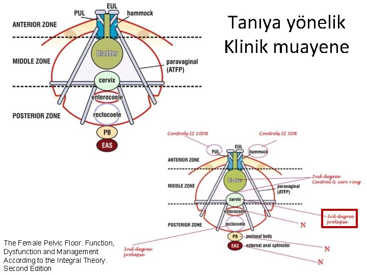 Tanıya yönelik Klinik muayene The Female Pelvic Floor. Function, Dysfunction and Management According to