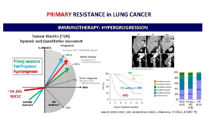 PRIMARY RESISTANCE in LUNG CANCER IMMUNOTHERAPY: HYPERGROGRESSION Tumour Kinetics (TGR): Dynamic and Quantitative assesment