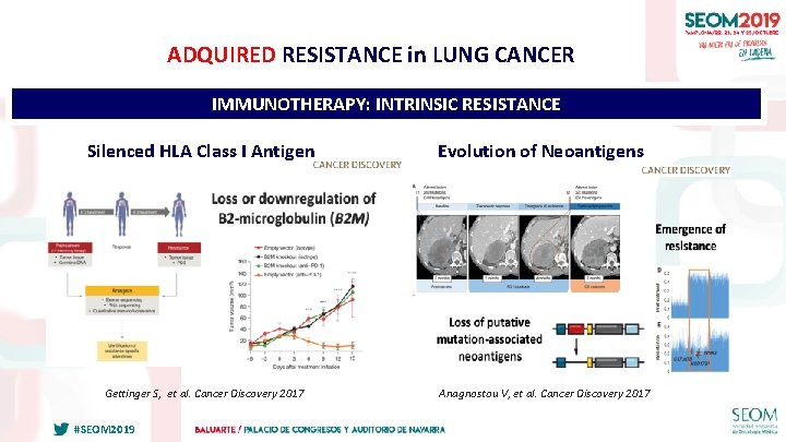 ADQUIRED RESISTANCE in LUNG CANCER IMMUNOTHERAPY: INTRINSIC RESISTANCE Silenced HLA Class I Antigen Gettinger