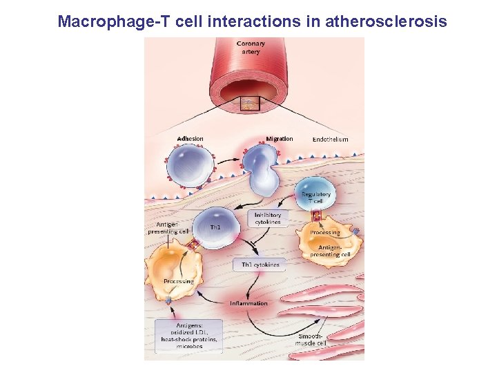 Macrophage-T cell interactions in atherosclerosis 