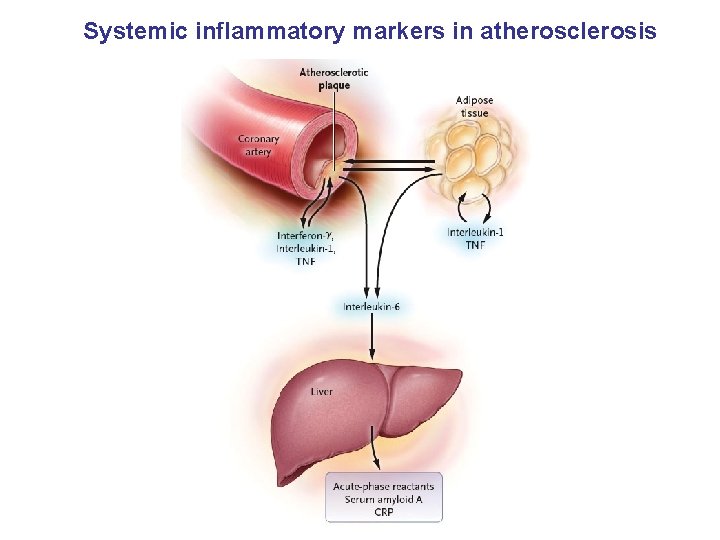 Systemic inflammatory markers in atherosclerosis 