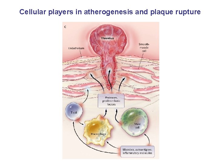Cellular players in atherogenesis and plaque rupture 