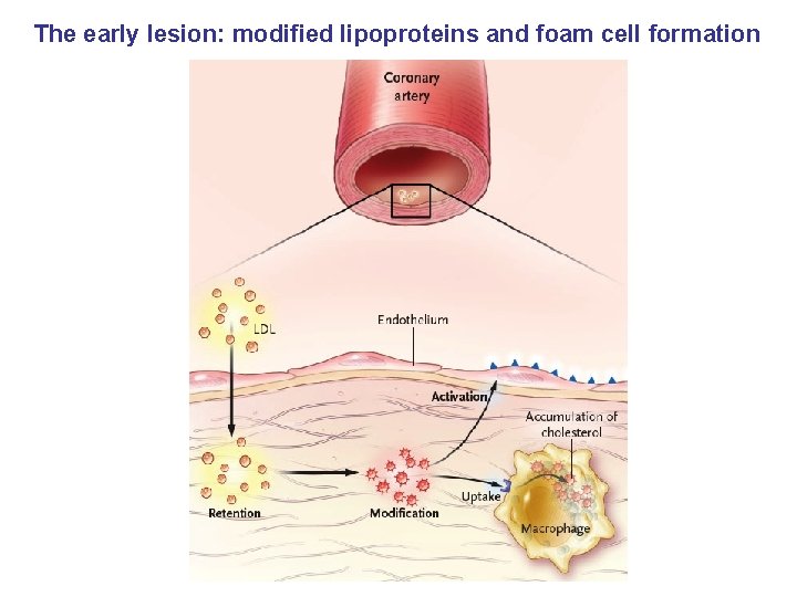 The early lesion: modified lipoproteins and foam cell formation 