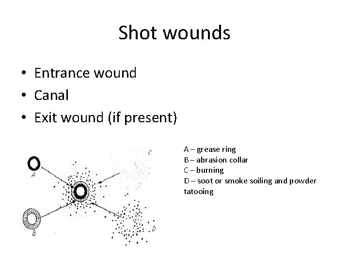 Shot wounds • Entrance wound • Canal • Exit wound (if present) A –