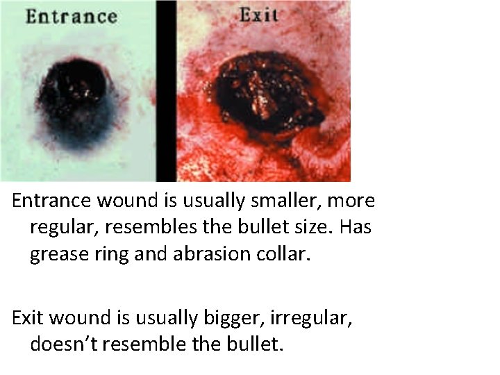 Entrance wound is usually smaller, more regular, resembles the bullet size. Has grease ring