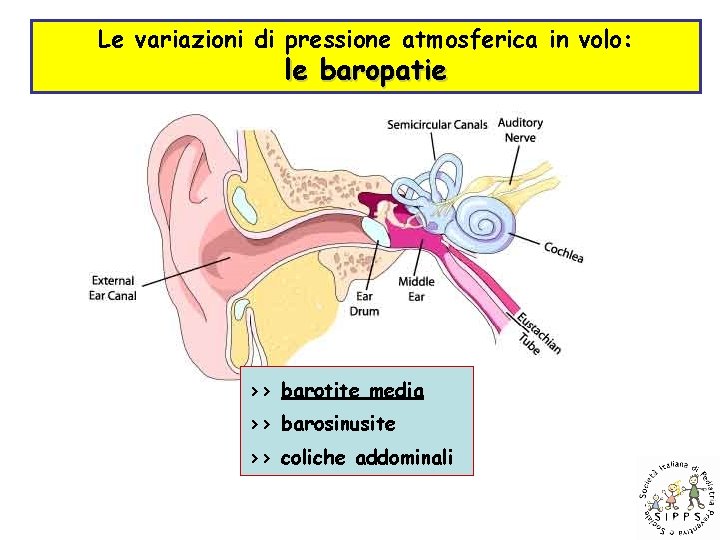 Le variazioni di pressione atmosferica in volo: le baropatie >> barotite media >> barosinusite