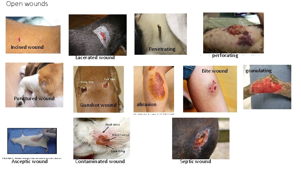 Open wounds Incised wound Penetrating perforating Lacerated wound Bite wound Punctured wound Asceptic wound Open wounds Incised wound Penetrating perforating Lacerated wound Bite wound Punctured wound Asceptic wound