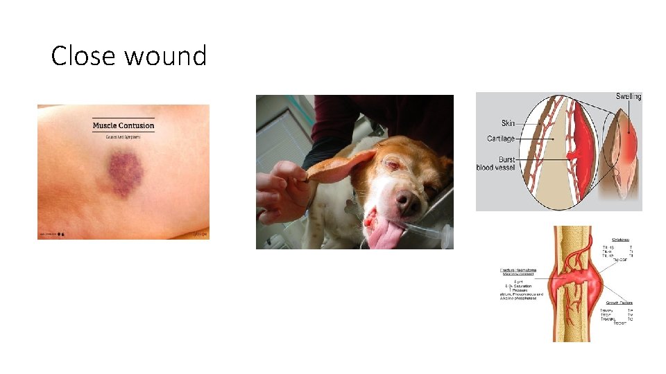 Close wound Close wound