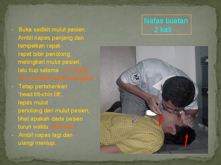 - Buka sedikit mulut pasien. Ambil napas panjang dan tempelkan rapat bibir penolong melingkari