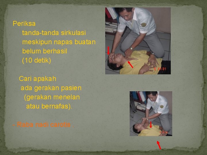 Periksa tanda-tanda sirkulasi meskipun napas buatan belum berhasil (10 detik) Cari apakah ada gerakan