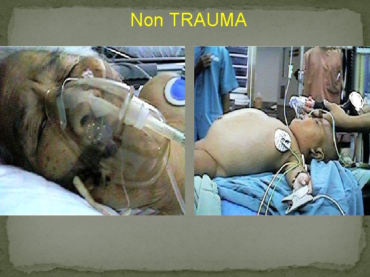Non TRAUMA 