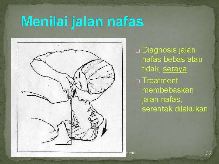 Menilai jalan nafas Diagnosis jalan nafas bebas atau tidak, seraya � Treatment membebaskan jalan