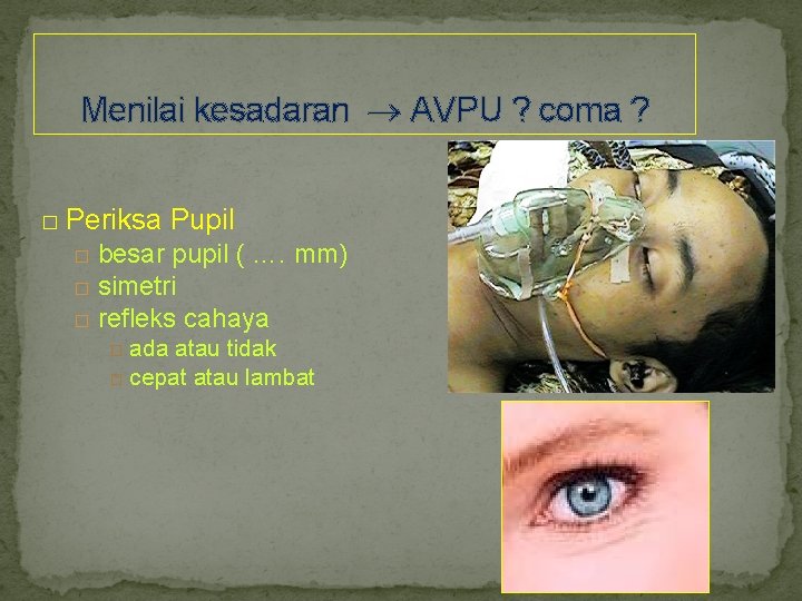 Menilai kesadaran AVPU ? coma ? � Periksa Pupil besar pupil ( …. mm)