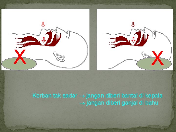 X X Korban tak sadar jangan diberi bantal di kepala jangan diberi ganjal di