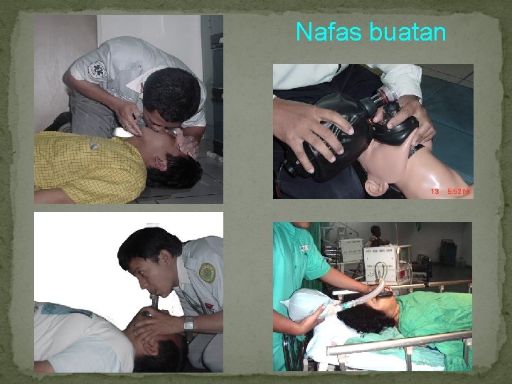 Nafas buatan 