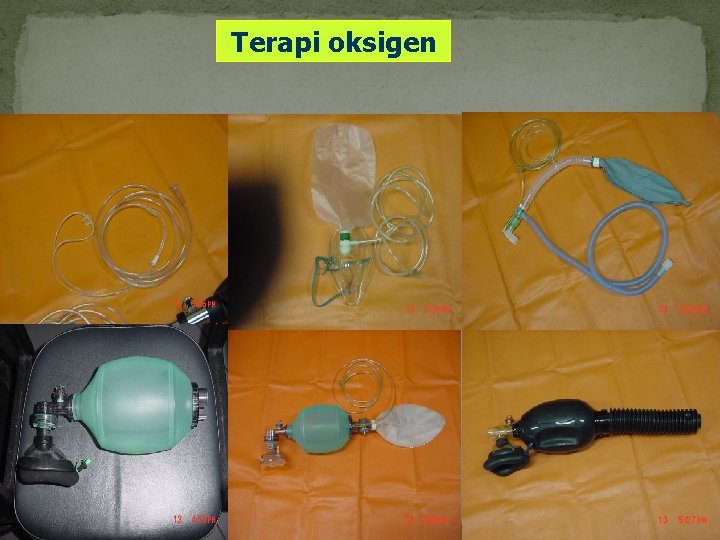 Terapi oksigen 