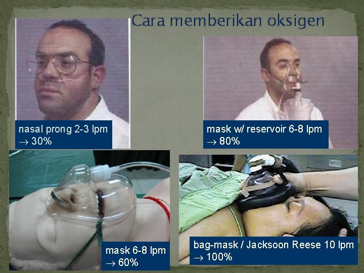 Cara memberikan oksigen nasal prong 2 -3 lpm 30% mask 6 -8 lpm 60%