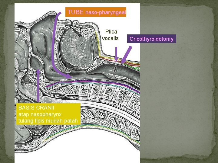TUBE naso-pharyngeal Plica vocalis BASIS CRANII atap nasopharynx tulang tipis mudah patah Cricothyroidotomy 