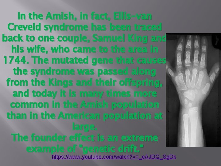In the Amish, in fact, Ellis-van Creveld syndrome has been traced back to one In the Amish, in fact, Ellis-van Creveld syndrome has been traced back to one