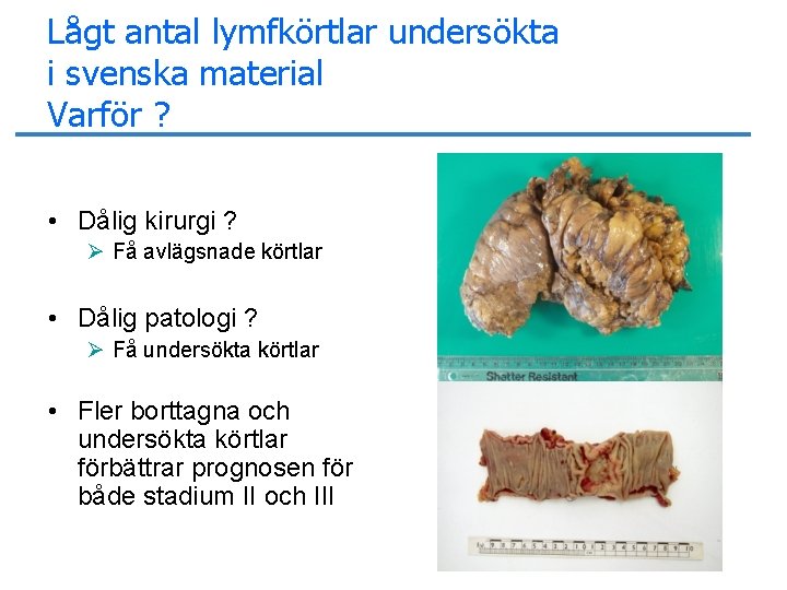 Lågt antal lymfkörtlar undersökta i svenska material Varför ? • Dålig kirurgi ? Ø