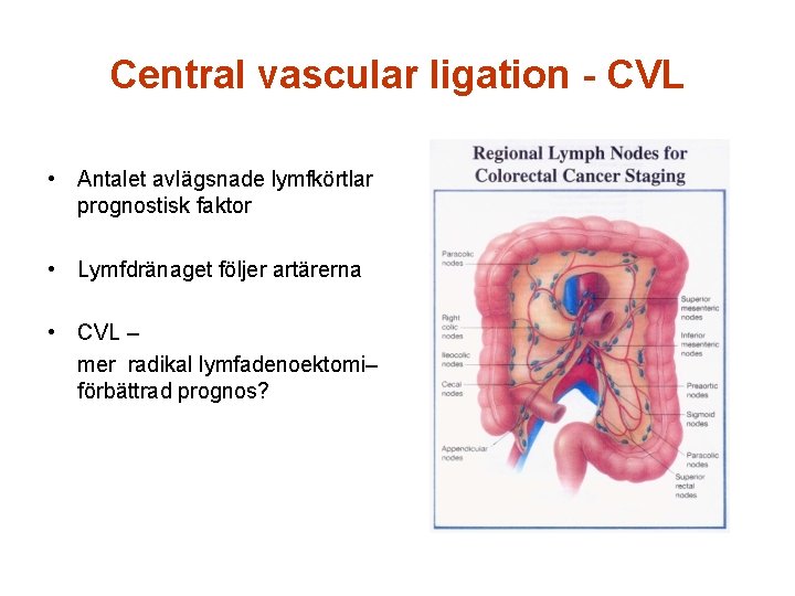 Central vascular ligation - CVL • Antalet avlägsnade lymfkörtlar prognostisk faktor • Lymfdränaget följer