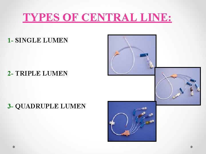 TYPES OF CENTRAL LINE: 1 - SINGLE LUMEN 2 - TRIPLE LUMEN 3 -