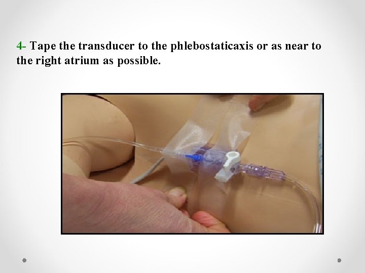 4 - Tape the transducer to the phlebostaticaxis or as near to the right