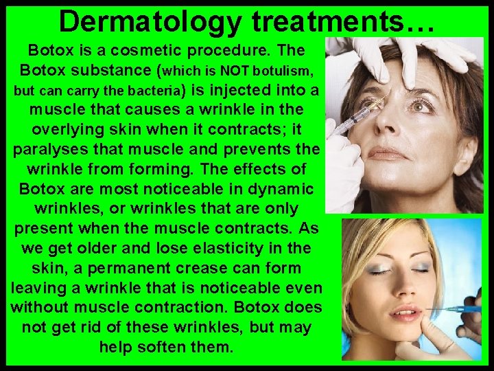 Dermatology treatments… Botox is a cosmetic procedure. The Botox substance (which is NOT botulism,