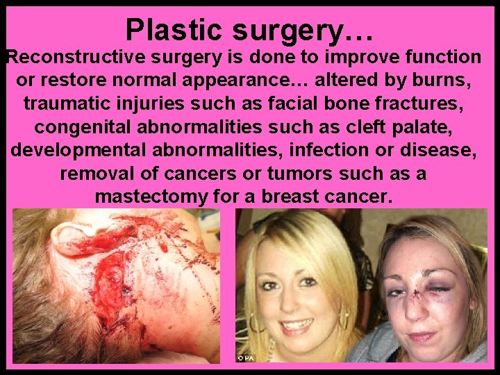 Plastic surgery… Reconstructive surgery is done to improve function or restore normal appearance… altered