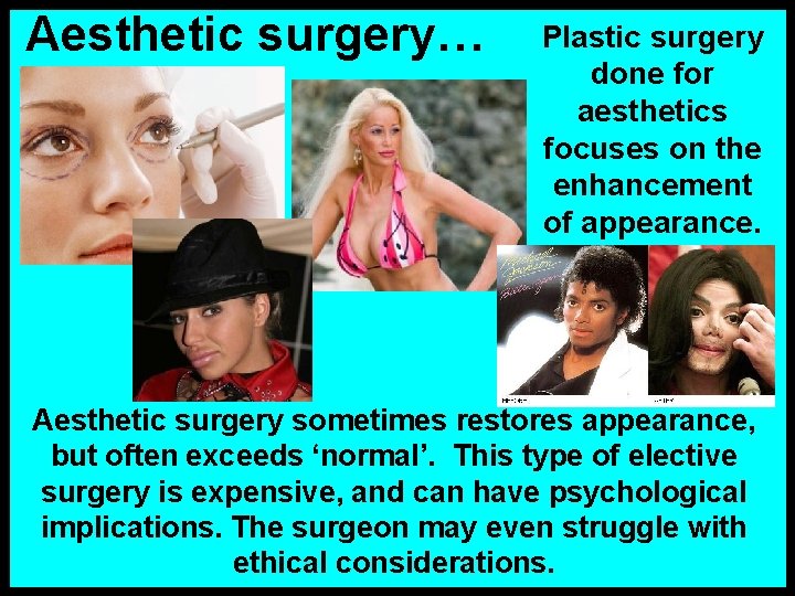 Aesthetic surgery… Plastic surgery done for aesthetics focuses on the enhancement of appearance. Aesthetic