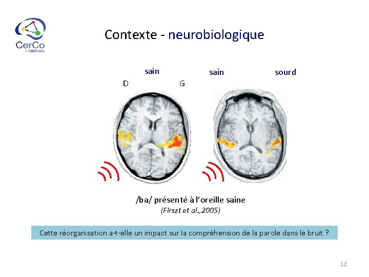 Contexte - neurobiologique sain D sain sourd G /ba/ présenté à l’oreille saine (Firszt