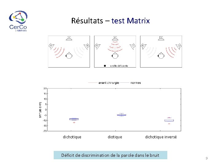 Résultats – test Matrix dichotique inversé Déficit de discrimination de la parole dans le