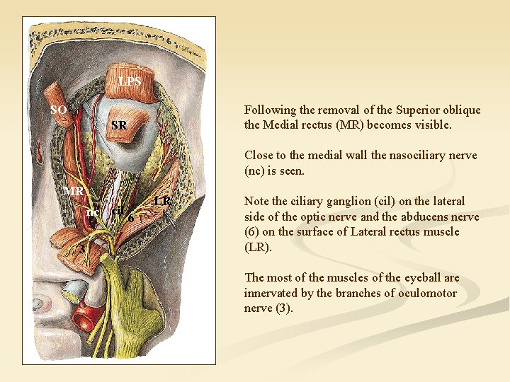 LPS SO Following the removal of the Superior oblique the Medial rectus (MR) becomes