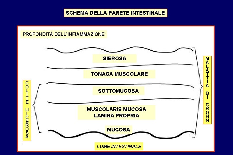 SCHEMA DELLA PARETE INTESTINALE PROFONDITÀ DELL’INFIAMMAZIONE SIEROSA TONACA MUSCOLARE C O L I T