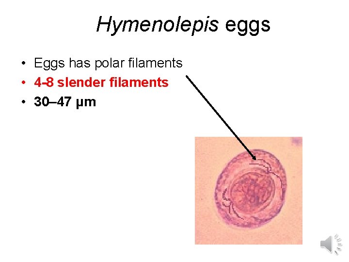 Hymenolepis eggs • Eggs has polar filaments • 4 -8 slender filaments • 30–