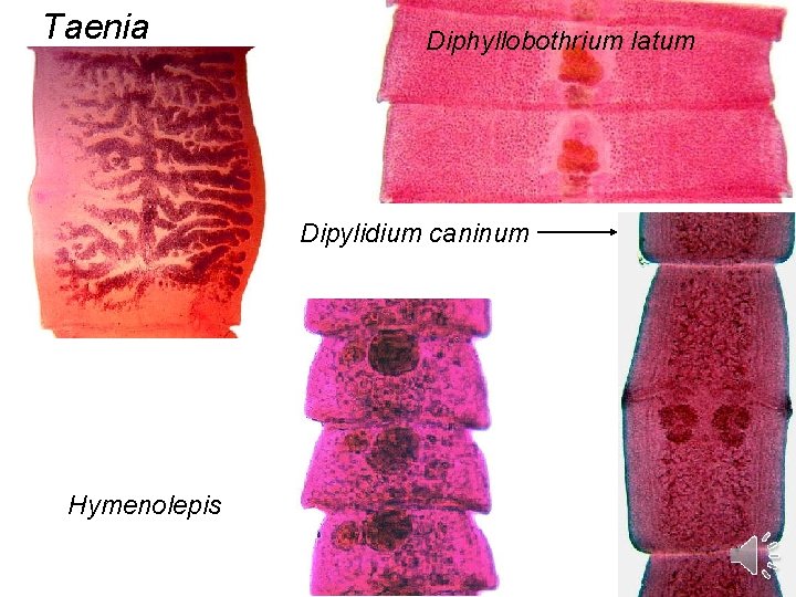 Taenia Diphyllobothrium latum Dipylidium caninum Hymenolepis 