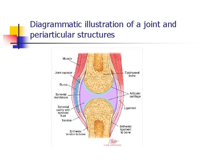 Diagrammatic illustration of a joint and periarticular structures 