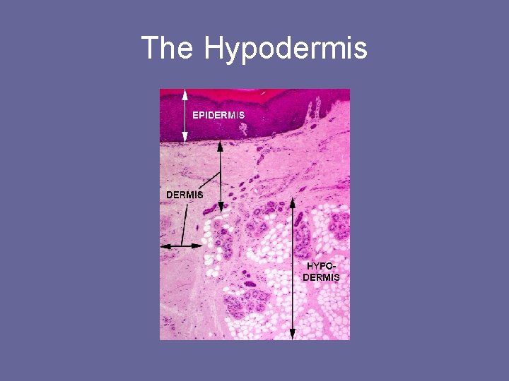 The Hypodermis The Hypodermis